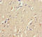 AP2M1 antibody, A53865-100, Epigentek, Immunohistochemistry paraffin image 