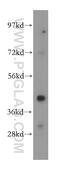 MAGE Family Member A10 antibody, 15295-1-AP, Proteintech Group, Western Blot image 