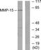 Matrix Metallopeptidase 15 antibody, TA314206, Origene, Western Blot image 