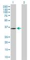 Zinc Finger C2HC-Type Containing 1A antibody, H00051101-B01P, Novus Biologicals, Western Blot image 