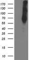LIM Domain Kinase 1 antibody, TA503162, Origene, Western Blot image 