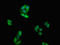 Cytotoxic T-Lymphocyte Associated Protein 4 antibody, LS-C669992, Lifespan Biosciences, Immunofluorescence image 