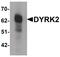 Dual specificity tyrosine-phosphorylation-regulated kinase 2 antibody, PA5-21125, Invitrogen Antibodies, Western Blot image 