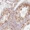 PWWP Domain Containing 3B antibody, HPA000168, Atlas Antibodies, Immunohistochemistry paraffin image 