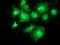 Microtubule-associated protein RP/EB family member 2 antibody, TA502860, Origene, Immunofluorescence image 