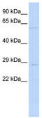 Mitochondrial Ribosomal Protein L10 antibody, TA340398, Origene, Western Blot image 