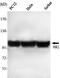 Hexokinase 2 antibody, M01389-2, Boster Biological Technology, Western Blot image 