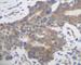 Placenta growth factor antibody, AHP1381, Bio-Rad (formerly AbD Serotec) , Immunohistochemistry paraffin image 