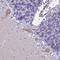 Divergent Protein Kinase Domain 1B antibody, HPA046812, Atlas Antibodies, Immunohistochemistry frozen image 