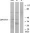 Olfactory Receptor Family 10 Subfamily V Member 1 antibody, TA316431, Origene, Western Blot image 