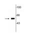 Tyrosine Hydroxylase antibody, NB300-109, Novus Biologicals, Western Blot image 