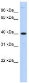 Metallophosphoesterase 1 antibody, TA338635, Origene, Western Blot image 