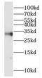 Homeobox D8 antibody, FNab03989, FineTest, Western Blot image 