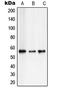 RUNX Family Transcription Factor 2 antibody, LS-C351937, Lifespan Biosciences, Western Blot image 