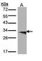 Major Histocompatibility Complex, Class II, DM Beta antibody, TA308239, Origene, Western Blot image 