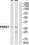Paired Related Homeobox 1 antibody, TA312787, Origene, Western Blot image 