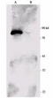 Ribosomal Protein S6 Kinase A1 antibody, TA326338, Origene, Western Blot image 