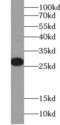 Steroid Receptor RNA Activator 1 antibody, FNab08213, FineTest, Western Blot image 