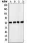 3-Phosphoinositide Dependent Protein Kinase 1 antibody, MBS821768, MyBioSource, Western Blot image 