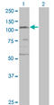 Structural Maintenance Of Chromosomes 3 antibody, LS-C139467, Lifespan Biosciences, Western Blot image 