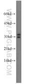 antibody, 14119-1-AP, Proteintech Group, Western Blot image 