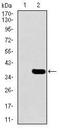 ACSB antibody, MA5-17175, Invitrogen Antibodies, Western Blot image 