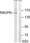 RAB3 GTPase Activating Non-Catalytic Protein Subunit 2 antibody, PA5-39386, Invitrogen Antibodies, Western Blot image 