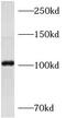 AP1B1 antibody, FNab00457, FineTest, Western Blot image 