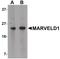 MARVEL Domain Containing 1 antibody, PA5-20853, Invitrogen Antibodies, Western Blot image 