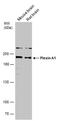 Plexin A1 antibody, PA5-78411, Invitrogen Antibodies, Western Blot image 