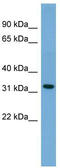 Gap Junction Protein Beta 3 antibody, TA329540, Origene, Western Blot image 
