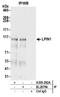 Phosphatidate phosphatase LPIN1 antibody, A305-282A, Bethyl Labs, Immunoprecipitation image 