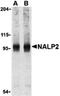 NBS1 antibody, orb74475, Biorbyt, Western Blot image 