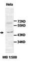 Forkhead Box Q1 antibody, orb77456, Biorbyt, Western Blot image 