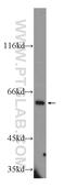 Transforming Growth Factor Beta Induced antibody, 10188-1-AP, Proteintech Group, Western Blot image 