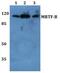 MKL/myocardin-like protein 2 antibody, PA5-37105, Invitrogen Antibodies, Western Blot image 