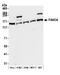 FA Complementation Group A antibody, A301-980A, Bethyl Labs, Western Blot image 