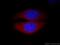 Calpain 2 antibody, 11472-1-AP, Proteintech Group, Immunofluorescence image 