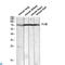 Coagulation Factor XIII B Chain antibody, LS-C813408, Lifespan Biosciences, Immunohistochemistry paraffin image 