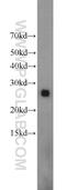 Mitochondrially Encoded NADH:Ubiquinone Oxidoreductase Core Subunit 1 antibody, 19703-1-AP, Proteintech Group, Western Blot image 