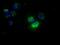 Nucleoside diphosphate kinase, mitochondrial antibody, GTX84028, GeneTex, Immunocytochemistry image 