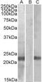Cystatin-8 antibody, GTX88034, GeneTex, Western Blot image 
