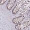 Zinc Finger Protein 362 antibody, PA5-63691, Invitrogen Antibodies, Immunohistochemistry frozen image 
