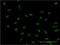 Protein Phosphatase 2 Regulatory Subunit B''Beta antibody, H00028227-M08, Novus Biologicals, Immunofluorescence image 