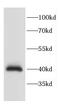 Calcium Voltage-Gated Channel Auxiliary Subunit Gamma 3 antibody, FNab01179, FineTest, Western Blot image 