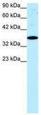 Hmr antibody, TA329707, Origene, Western Blot image 