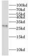 Motile sperm domain-containing protein 3 antibody, FNab05276, FineTest, Western Blot image 