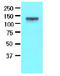 Ephrin type-A receptor 2 antibody, AM09008PU-S, Origene, Western Blot image 