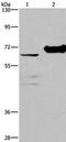 Choline Dehydrogenase antibody, PA5-50378, Invitrogen Antibodies, Western Blot image 