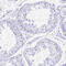 Chromosome 12 Open Reading Frame 56 antibody, HPA056986, Atlas Antibodies, Immunohistochemistry paraffin image 
